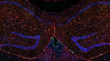 細胞生物學平臺光學顯微鏡的樣品制備方法及技巧專題在線講座通知