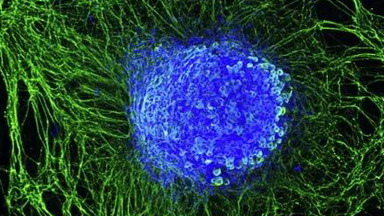 細胞生物學平臺激光共聚焦顯微鏡的原理和應用專題線上講座