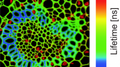 細胞影像平臺線上系列講座之熒光壽命成像及熒光相關光譜專題講座通知