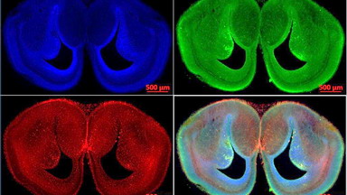 細胞生物學平臺Zeiss全自動數字玻片掃描系統線上培訓通知