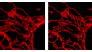 尼康生物影像中心超分辨激光掃描共聚焦顯微鏡線上培訓通知
