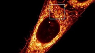 細胞生物學平臺超高分辨率顯微鏡技術專題線上講座通知