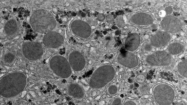 細胞生物學平臺電鏡機組透射電鏡染色技術線上培訓通知