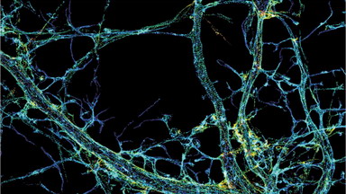 尼康生物影像中心超分辨率顯微鏡SIM和STORM技術進展講座通知