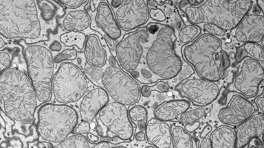 細胞生物學平臺電鏡機組貼壁細胞超薄切片技術線上培訓通知