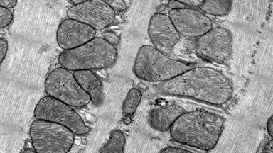 細胞生物學平臺電鏡機組透射電鏡樣品制備技術--心肌專題培訓通知