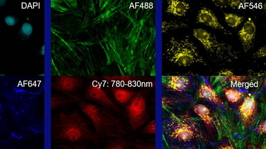 細胞生物學平臺線上專題講座共聚焦前沿應用--近紅外及上轉換成像介紹