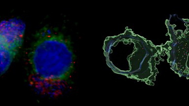 細胞影像平臺圖像處理--Imaris計數線下培訓