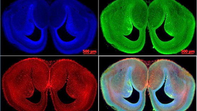 細胞生物學平臺Zeiss全自動數字玻片掃描系統培訓通知