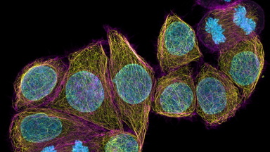 細胞影像平臺Zeiss LSM980 Airyscan2 激光共聚焦顯微鏡培訓通知