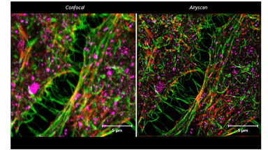 共享儀器平臺蔡司超高分辨激光共聚焦顯微鏡LSM880培訓通知