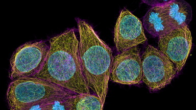 細胞影像平臺Zeiss LSM980 Airyscan2 激光共聚焦顯微鏡培訓通知