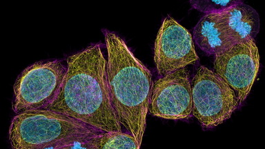 細胞影像平臺Zeiss LSM980 Airyscan2快速超分辨激光共聚焦顯微鏡培訓通知