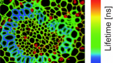 細胞影像平臺激光共聚焦顯微鏡及熒光壽命成像（FV1200-FLIM）上機培訓通知