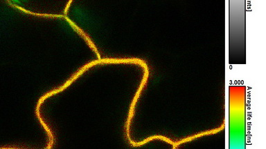 細胞影像平臺激光共聚焦顯微鏡及熒光壽命成像（FV1200-FLIM）上機培訓通知