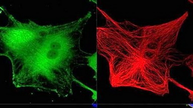 共享儀器平臺Zeiss LSM880超高分辨共聚焦顯微鏡上機培訓通知