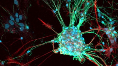 細胞影像平臺Zeiss LSM980 Airyscan2快速超分辨激光共聚焦顯微鏡培訓通知