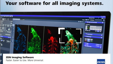 共享儀器平臺Zeiss共聚焦專題系列講座（四）ZEN軟件數據處理