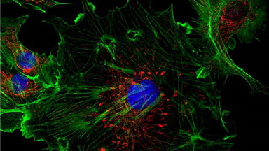 共享儀器平臺Zeiss LSM880超高分辨共聚焦顯微鏡上機培訓通知