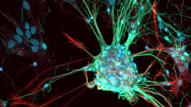 細胞影像平臺Zeiss LSM980 Airyscan2快速超分辨激光共聚焦顯微鏡培訓通知