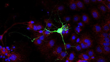 共享儀器平臺Zeiss LSM880超高分辨共共聚焦顯微鏡上機培訓通知