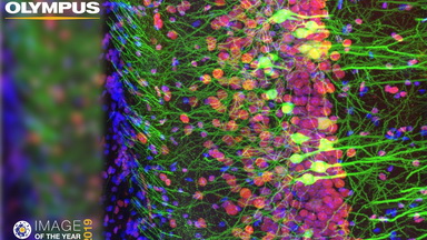 細胞生物學平臺Olympus激光共聚焦顯微鏡FV3000線上培訓通知