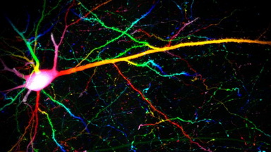 細胞影像平臺Zeiss LSM980 Airyscan2快速超分辨激光共聚焦顯微鏡培訓通知