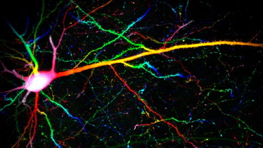 細胞影像平臺Zeiss LSM980 Airyscan2快速超分辨激光共聚焦顯微鏡培訓通知