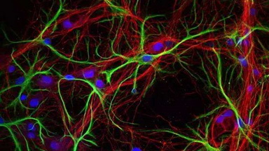 共享儀器平臺蔡司超高分辨激光共聚焦顯微鏡LSM880線上培訓通知