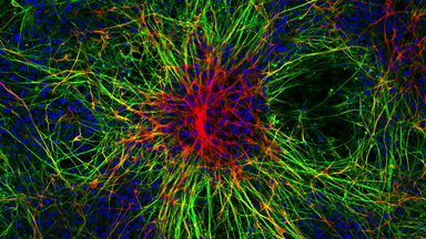 尼康生物影像中心超分辨激光掃描共聚焦顯微鏡上機培訓通知