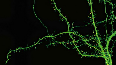 尼康生物影像中心超分辨激光掃描共聚焦顯微鏡上機培訓通知
