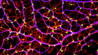 尼康生物影像中心Nikon A1 HD25超分辨激光掃描共聚焦顯微鏡免費試用及培訓通知