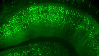 共享儀器平臺Zeiss Lightsheet Z.1激光片層掃描顯微鏡線上培訓通知