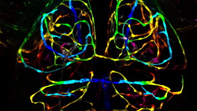 細胞影像平臺Zeiss LSM980 Airyscan2快速超分辨激光共聚焦顯微成像Workshop