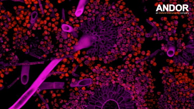 細胞影像平臺轉盤共聚焦顯微鏡上機培訓通知