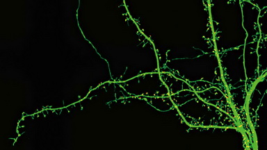 尼康生物影像中心超分辨激光掃描共聚焦顯微鏡上機培訓通知