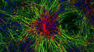 尼康生物影像中心超分辨激光掃描共聚焦顯微鏡上機培訓通知
