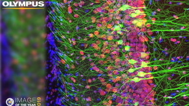 細胞生物學平臺Olympus激光共聚焦顯微鏡FV3000培訓通知