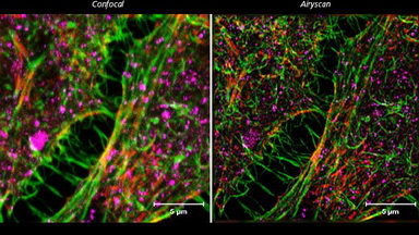 共享儀器平臺超高分辨激光共聚焦顯微鏡Zeiss LSM880上機培訓通知