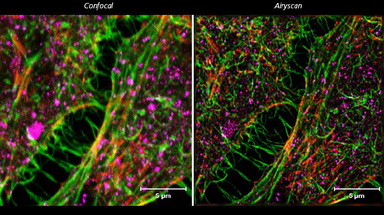 共享儀器平臺超高分辨激光共聚焦顯微鏡Zeiss LSM880上機培訓通知