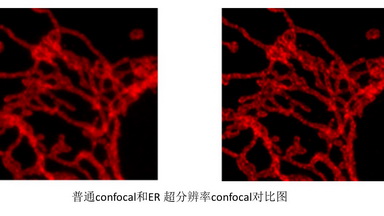 尼康生物影像中心超分辨激光掃描共聚焦顯微鏡上機培訓通知