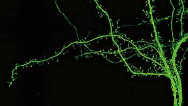 尼康生物影像中心超分辨激光掃描共聚焦顯微鏡上機培訓通知