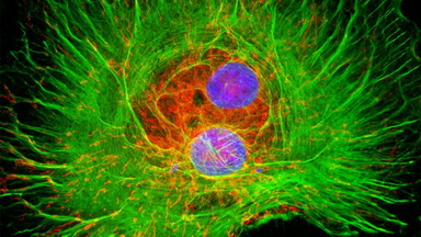 尼康生物影像中心超分辨激光掃描共聚焦顯微鏡上機培訓通知
