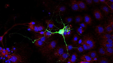 共享儀器平臺超高分辨共聚焦顯微鏡Zeiss LSM880上機培訓通知