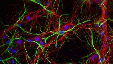 共享儀器平臺超高分辨激光共聚焦顯微鏡Zeiss LSM880上機培訓通知