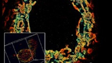 細胞生物學平臺Abbelight 3D單分子定位超分辨系統Workshop通知