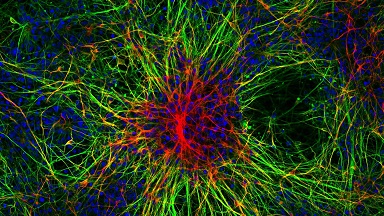 尼康生物影像中心超分辨激光掃描共聚焦顯微鏡上機培訓通知