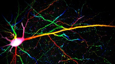 細胞影像平臺Zeiss LSM980 Airyscan2快速超分辨激光共聚焦顯微鏡培訓通知