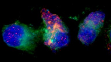 細胞影像平臺圖像處理 Imaris 計數類問題專題培訓通知