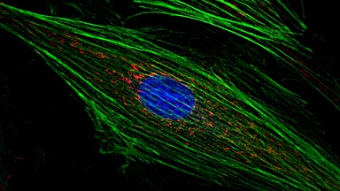 細胞影像平臺高分辨率活細胞成像系統培訓通知